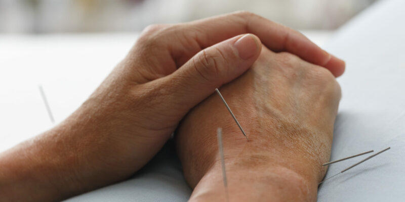 Lassen Akupunktur