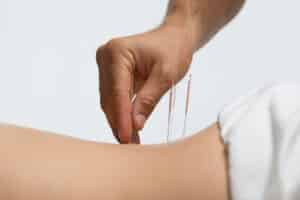 kvinde som får akupunktur imod hoftesmerter
