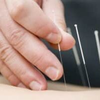 Akupunkturbehandling imod håndledssmerter