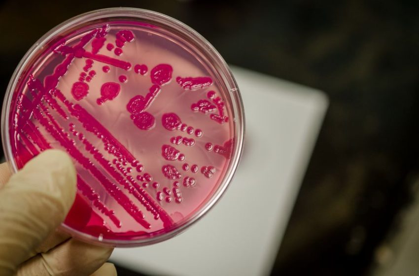  مقاومة “البكتريا” للمضادات الحيوية في إزدياد بالسويد