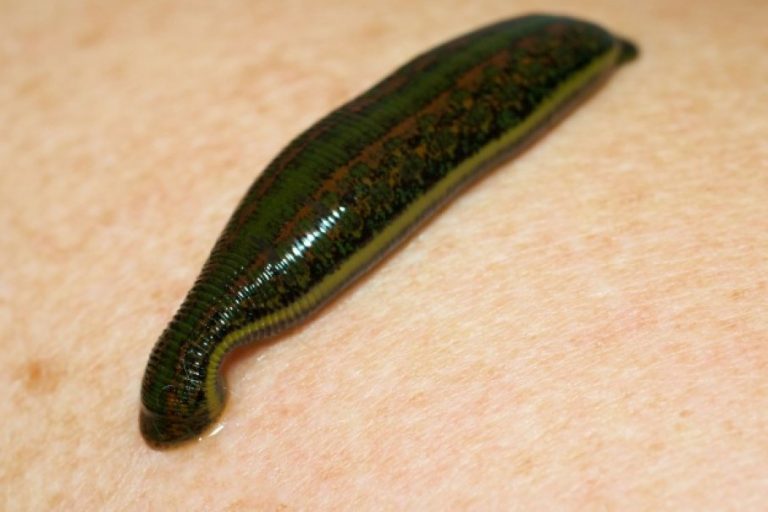 Medicinal Leeches