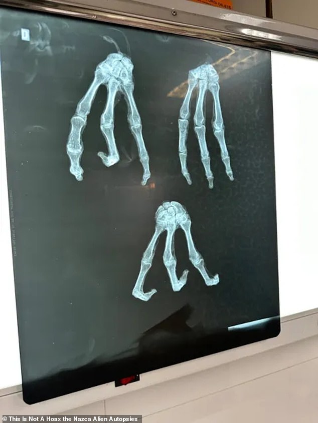 Thus far, the filmmaking pair report that they have had X-rays (above), DNA, and other laboratory examinations conducted on one of the apparently mummified bodies, filmed in collaboration with scientists from the United States on location in Mexico and Peru