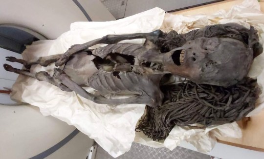 *EMBARGOED UNTIL 05.15 BST, FRIDAY AUGUST 2 (00.15 ET)* The Screaming Woman in the CT scan. Photo released August 1 2024.A mummy known as the 'Screaming Woman' may have died in agony 3,500 years ago, suggests new research.The Egyptian woman was embalmed with expensive imported ingredients - suggesting her expression was caused by pain rather than poor embalming, say scientists.In Deir Elbahari near Luxor, the site of ancient Thebes, In 1935, an archaeological expedition excavated the tomb of Senmut, the architect and overseer of royal works ? and reputedly, lover ? of the famed queen Hatschepsut. Beneath Senmut's tomb, they found a separate burial chamber for his mother Hat-Nufer and other, unidentified relatives.