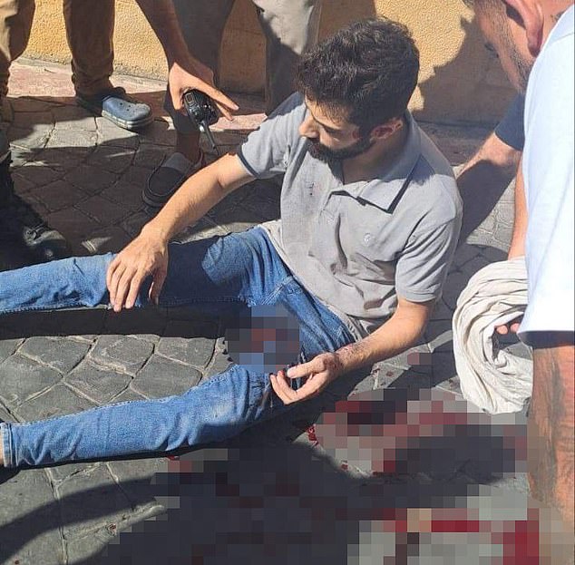 Pagers used by Hezbollah members for vital communications exploded on Tuesday, injuring thousands. On Wednesday, radios and walkie-talkies, like the one pictured in the hand of the man standing over the victim here, also exploded