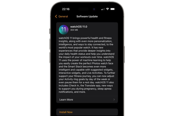 watchOS 11 Software Update.