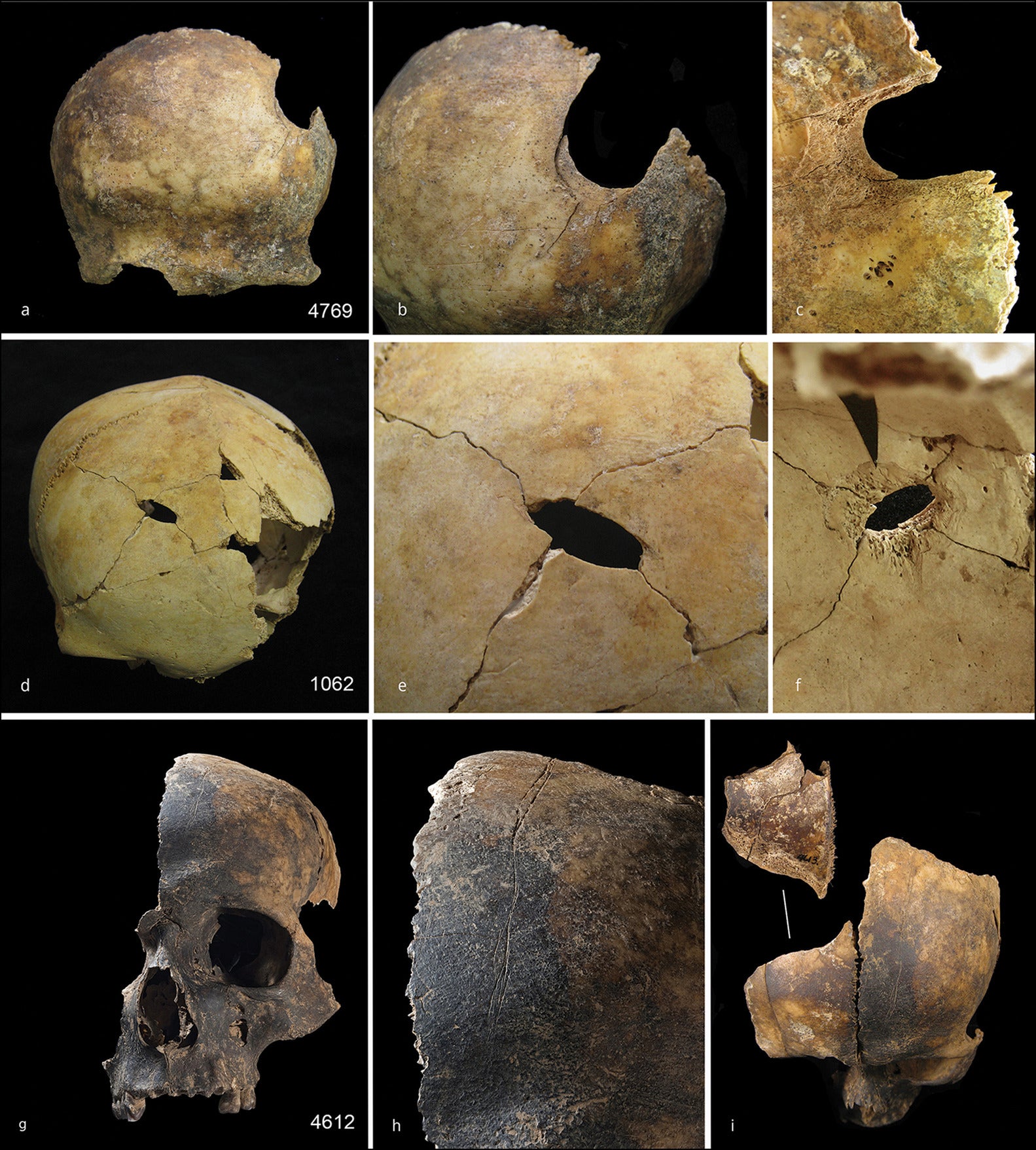 Evidence of injuries on the bones