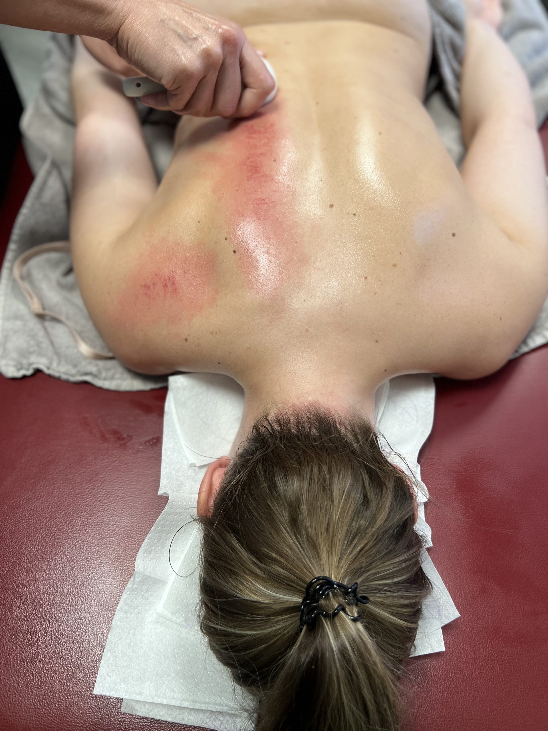 gua-sha skrapmassage