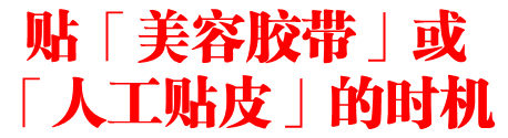 贴「美容胶带」或「人工贴皮」的时机