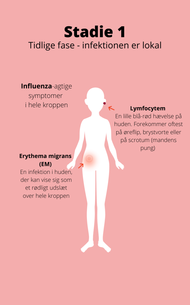 Symptomer | Flåtoverførte sygdomme