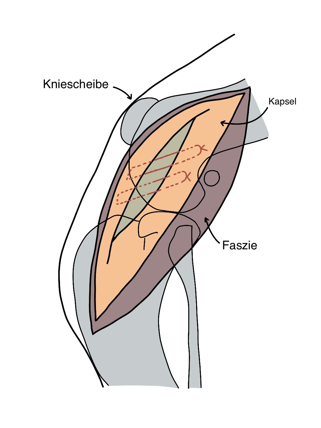 Meustege 1