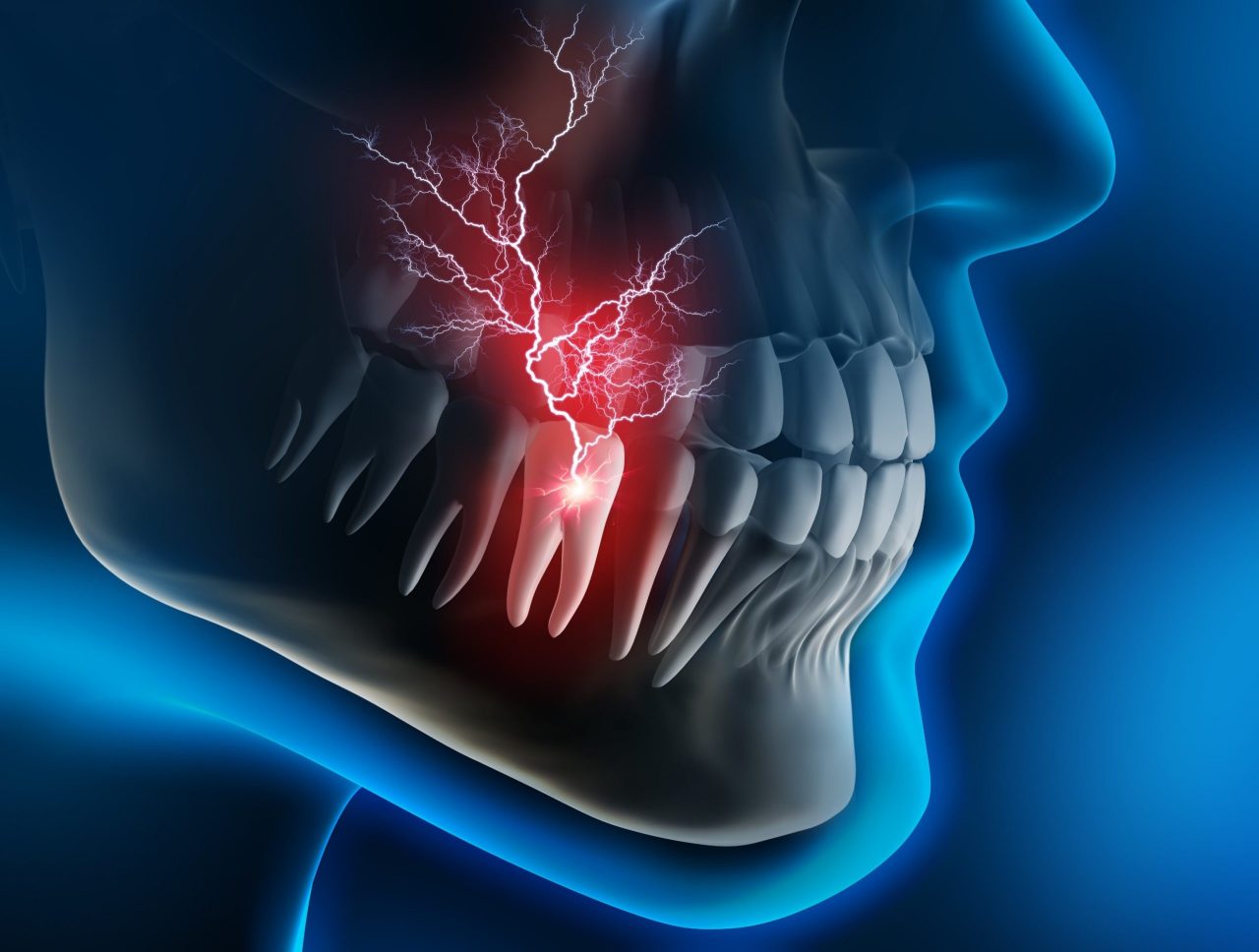 toothache-scaled