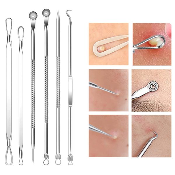 15Pcs Stainless Steel Blackhead Remover Pimple Popper Tools Kit with Metal Case_4