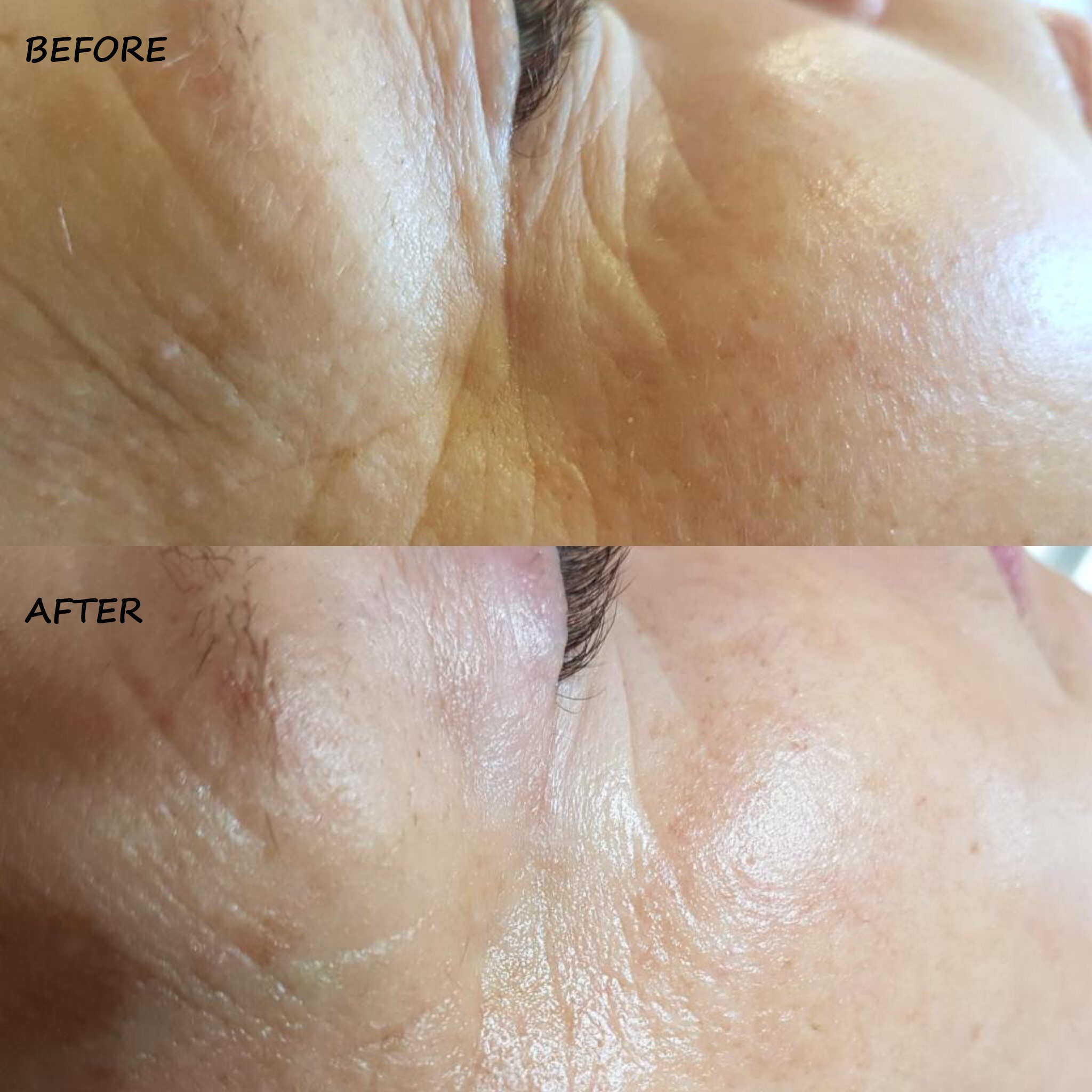 DermaOxy Before & After images