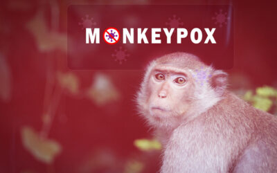 Monkeypox Outbreak Guide