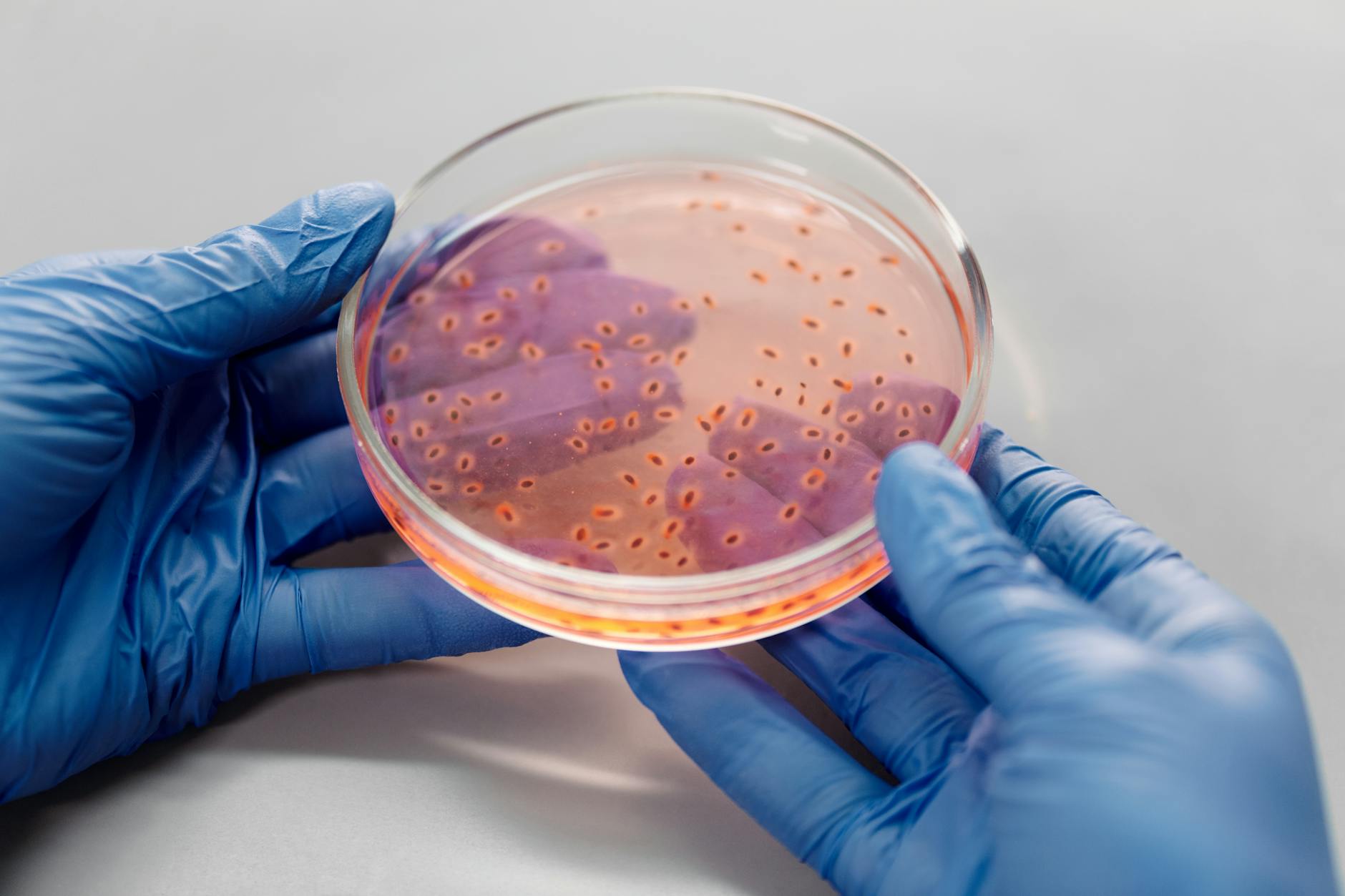 live bacteria in a petri dish