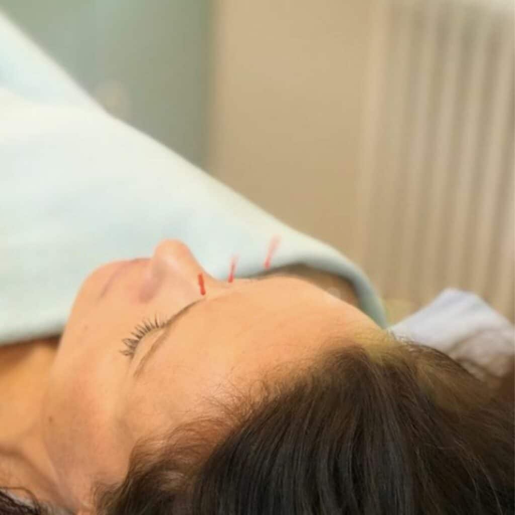 akupunktur er beroligende - man slapper godt av under behandlingen