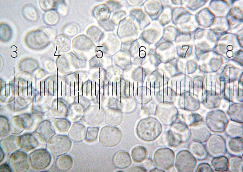 Gærceller under mikroskop