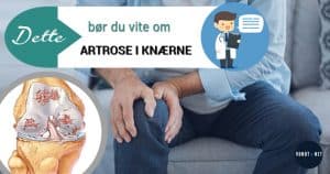 artrose i KNÆRNE