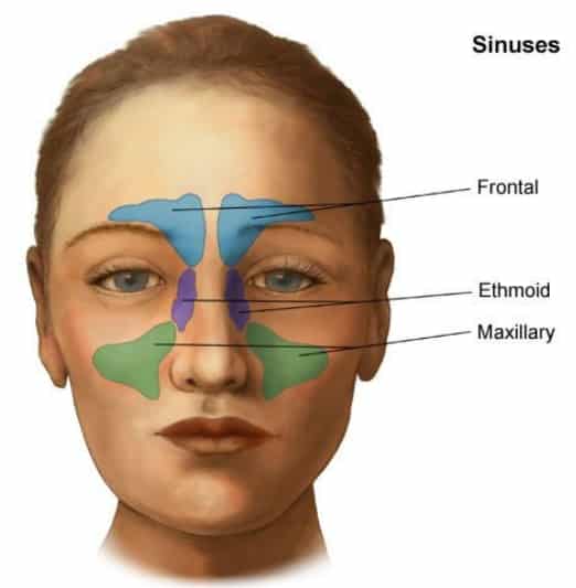 Sinusitis - Eine mögliche Ursache für Augenschmerzen.