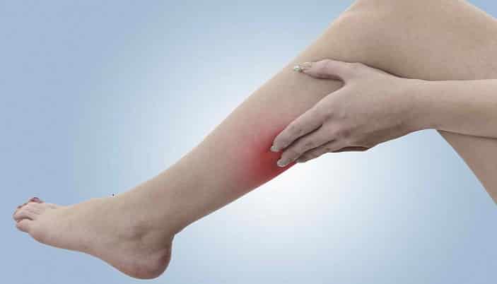 blodpropp i leggen