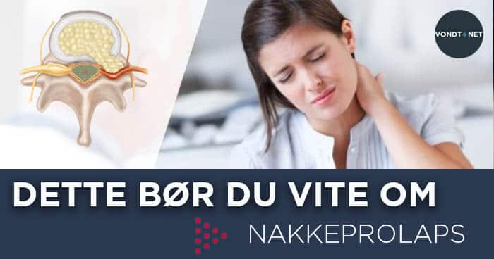 dette bør du vite om nakkeprolaps