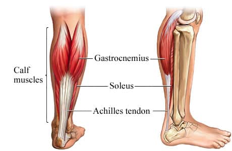 gastrocsoleus