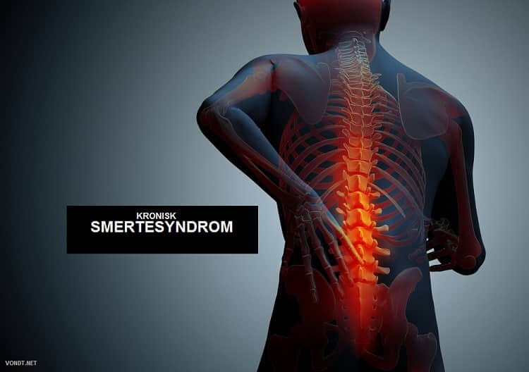 Chronisch pijnsyndroom Wanneer de pijn chronisch wordt