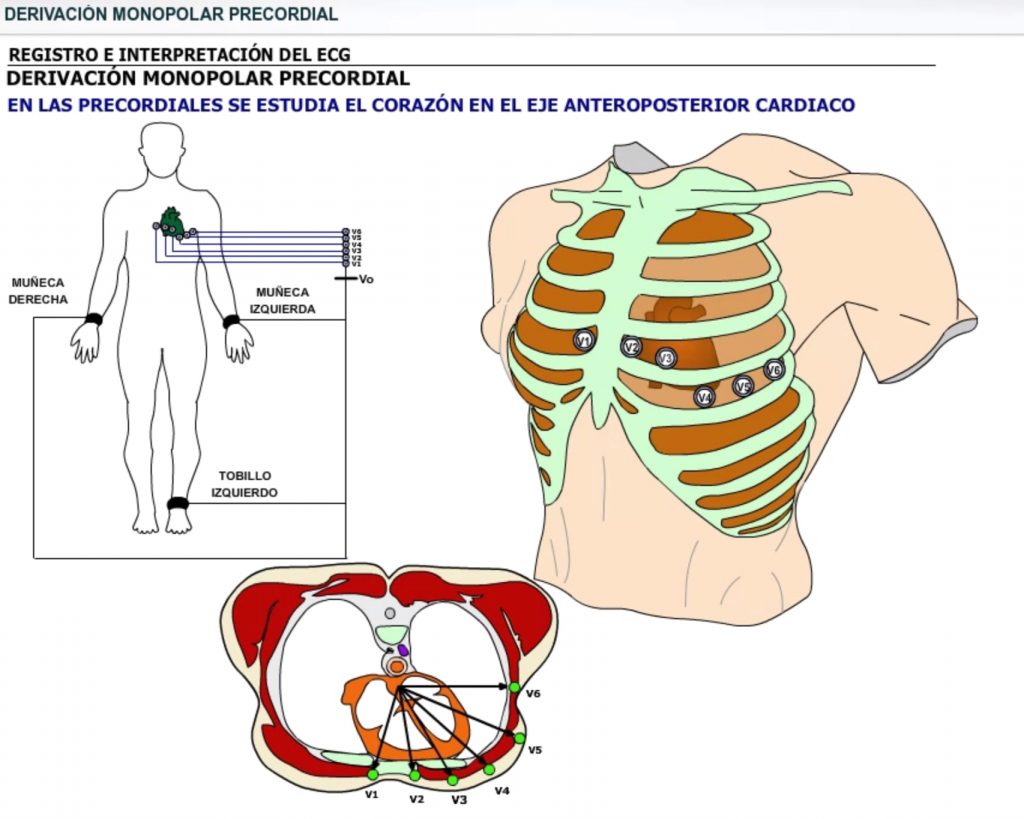 Derivaciones precordiales monopolares