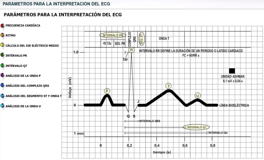 Elementos de un ECG