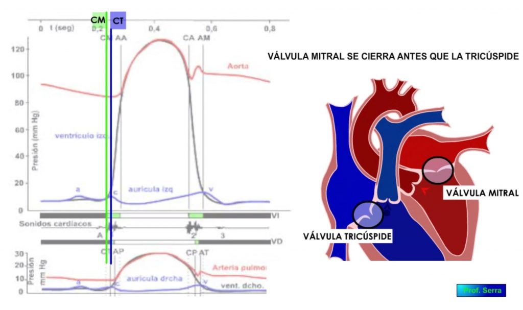 cierre válvula mitral y tricúspide