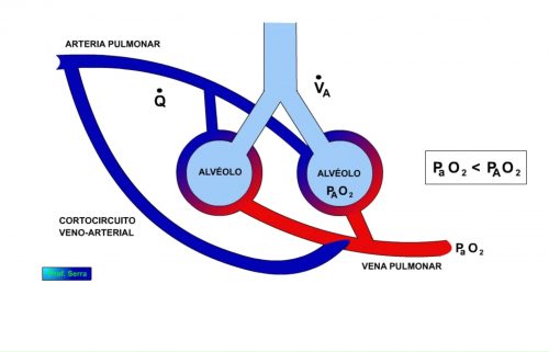 Arterialización