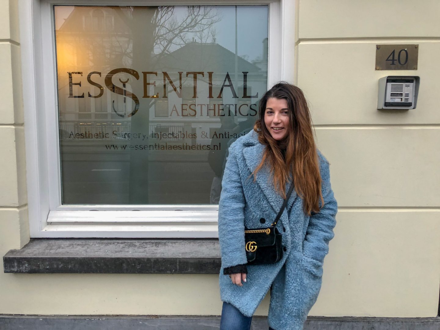 Personal | Traangootjes opvullen bij Essential Aesthetics