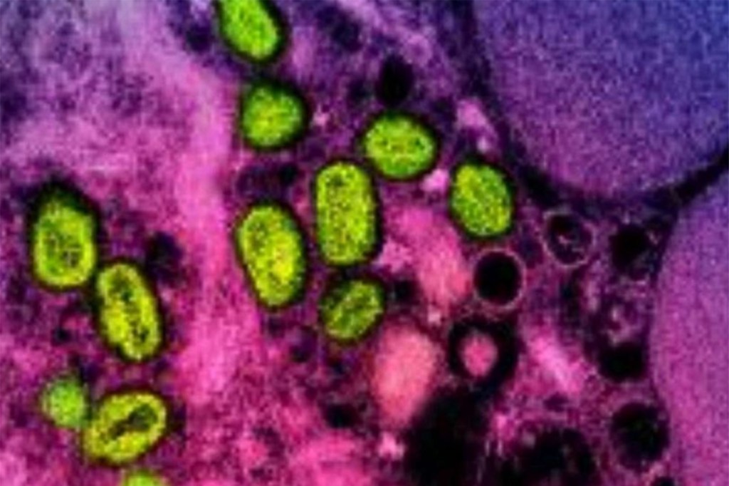 A colorized transmission electron micrograph of monkeypox particles (green) found within an infected cell (pink and purple), cultured in the laboratory.