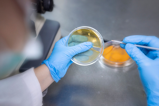 Microbiologist is reading the microbiological test result in laboratory.