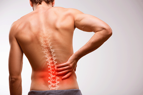 CBD-Rückenschmerzen