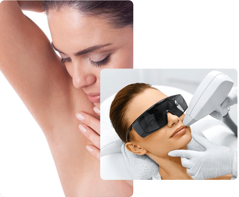 Diode laserbehandeling bij your beauty clinic