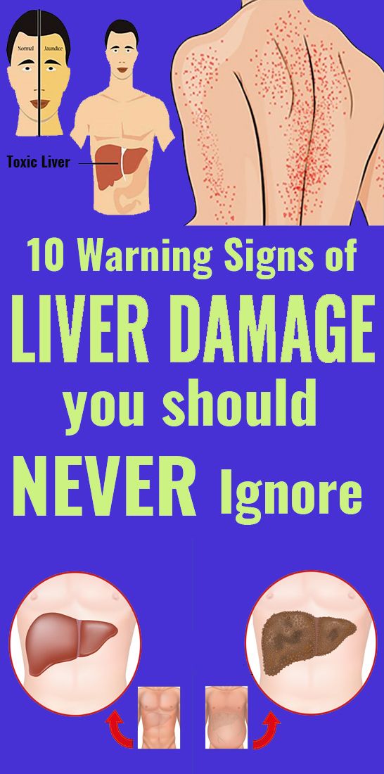 10 Warning Signals of Liver Damage You Should Not Ignore