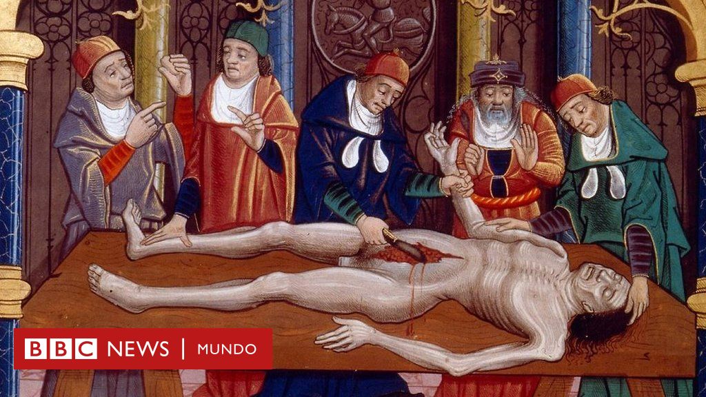 Ilustración medieval de una autopsia realizada en la edad media. Del manuscrito francés "Las propiedades de las cosas" de Bartholomaeus Anglicus, finales del siglo XV.